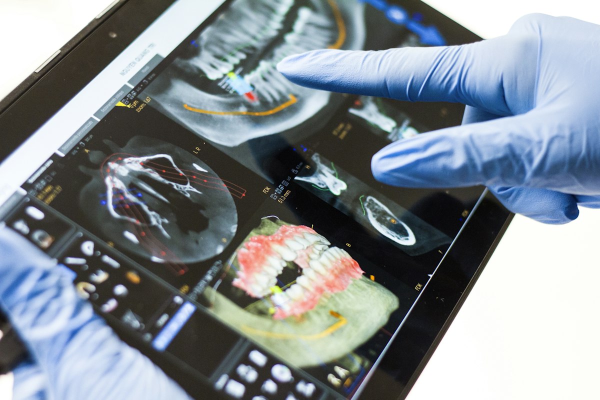Gloved hand pointing at a digital dental scan on a tablet