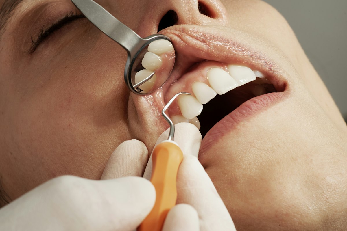 Dentist examining a patient with a dental mirror